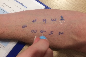 General Medical Practice de Makroon Amsterdam allergy test